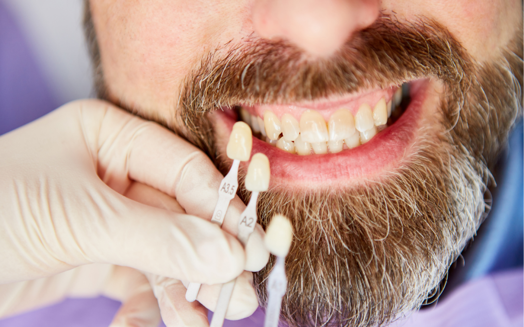 Top Causes of Tooth Discoloration and How to Prevent It | Queens Crossing Dental