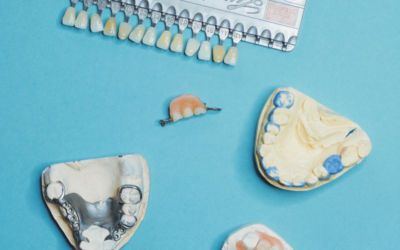 Can Veneers Fix Crooked Teeth?