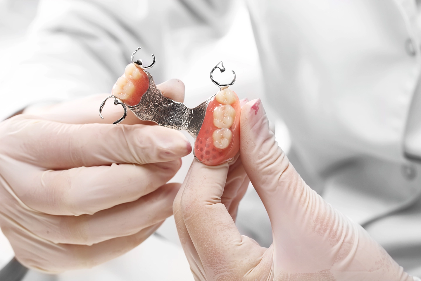 Partial dentures for replacing multiple missing teeth