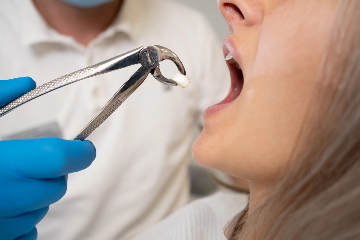 Patient recovering after tooth extraction