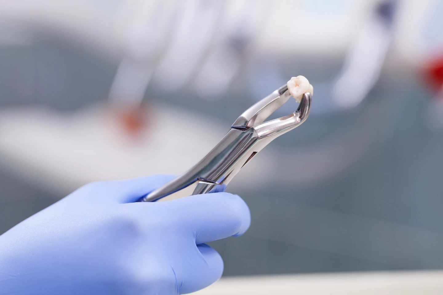 Dentist performing a simple tooth extraction
